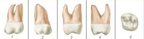 số thứ tự của các răng trên hàm răng 15