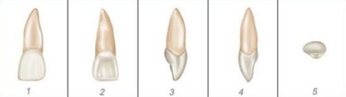 số thứ tự của các răng trên hàm răng 3