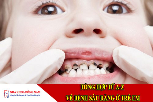 tổng hợp từ a-z về bệnh sâu răng ở trẻ em