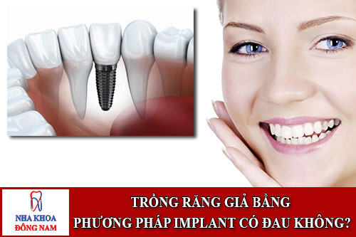 trồng răng giả bằng phương pháp implant có đau không?