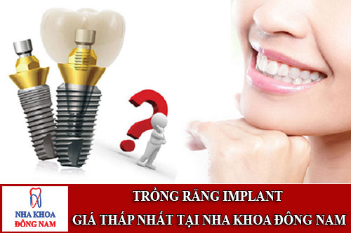 trồng răng implant giá thấp nhất tại nha khoa đông nam