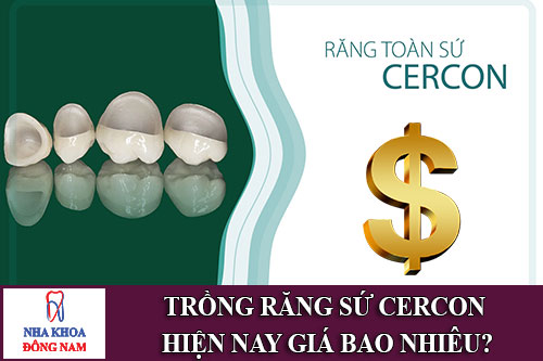 trồng răng sứ cercon hiện nay giá bao nhiêu