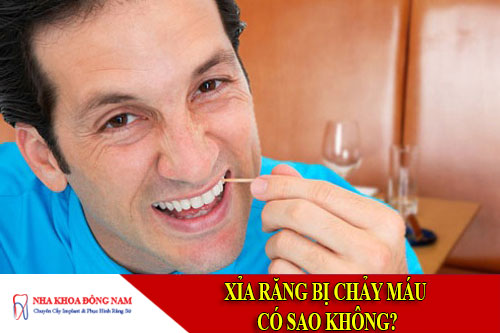 xỉa răng bị chảy máu có sao không