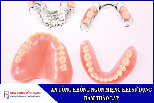 ăn uống không ngon miệng khi sử dụng hàm giả tháo lắp