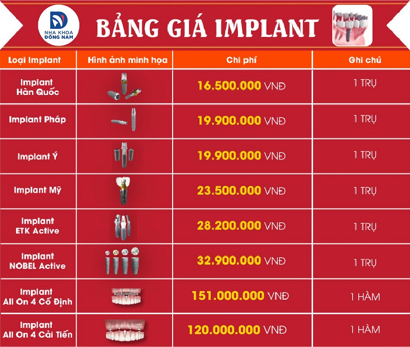 Bảng giá implant tại nha khoa Đông Nam