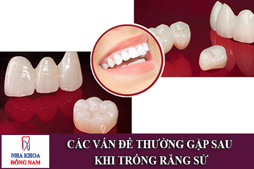 các vấn đề thường gặp sau khi trồng răng sứ