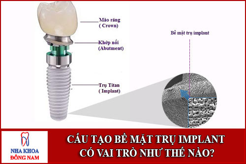Cấu Tạo Bề Mặt Trụ Implant Có Vai Trò Như Thế Nào-