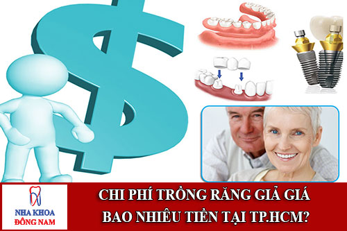 trồng răng giả giá bao nhiêu tiền tại tp.hcm