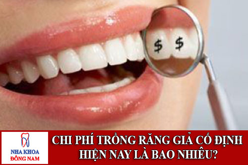 chi phí trồng răng giả cố định hiện nay là bao nhiêu