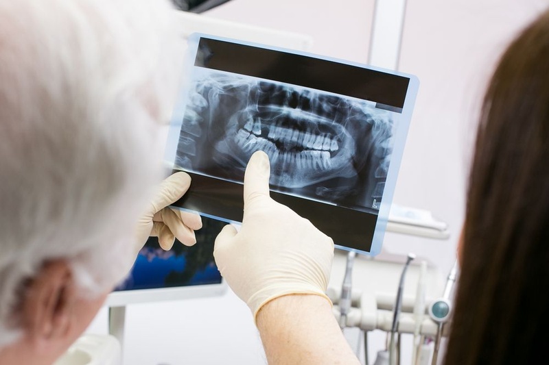Chi phí trồng răng giả phụ thuộc vào số lượng răng mất cần phục hình