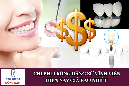 chi phí trồng răng sứ vĩnh viễn giá bao nhiêu