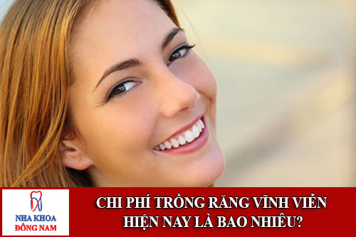 chi phí trồng răng vĩnh viễn hiện nay bao nhiêu?