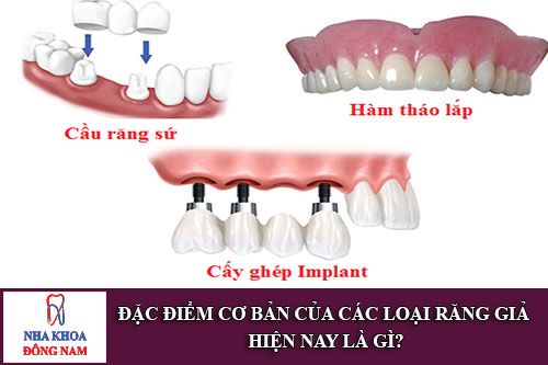 dac-diem-co-ban-cua-cac-loai-rang-gia-hien-nay-la-gi