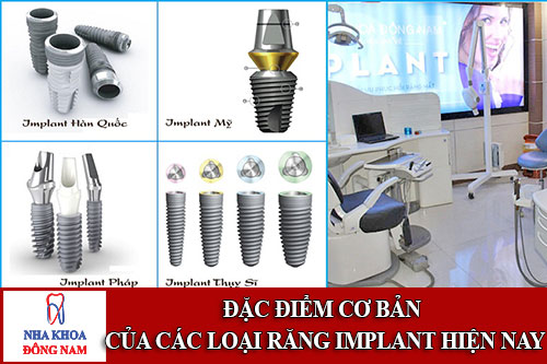 đặc điểm cơ bản của các loại răng implant hiện nay