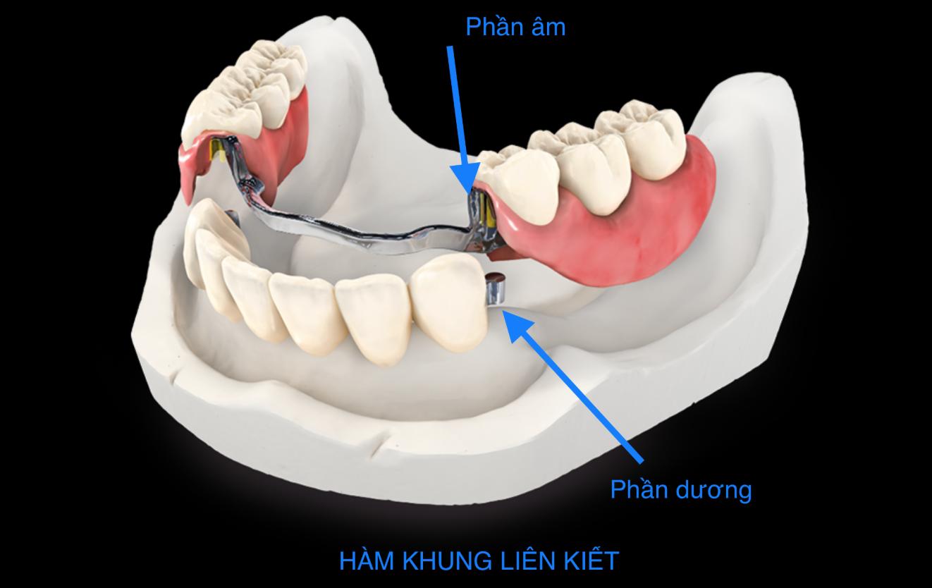 Khung hàm liên kết
