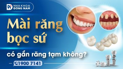 Mài răng bọc sứ có gắn răng tạm không?