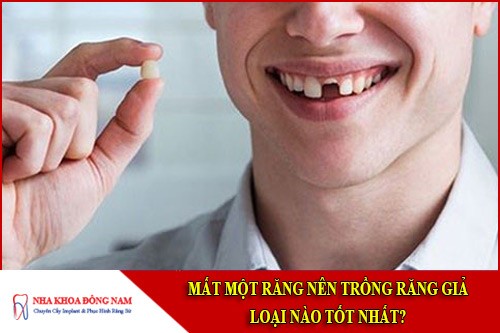 mất một răng nên trồng răng giả loại nào là tốt nhất