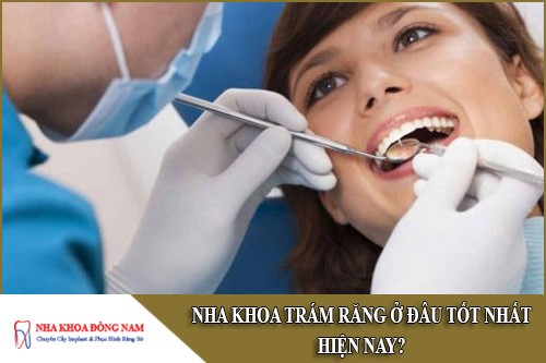 nha khoa trám răng ở đâu tốt nhất hiện nay