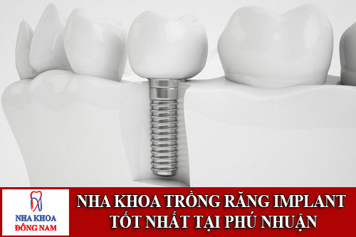 nha khoa trồng răng implant tốt nhất tại phú nhuận