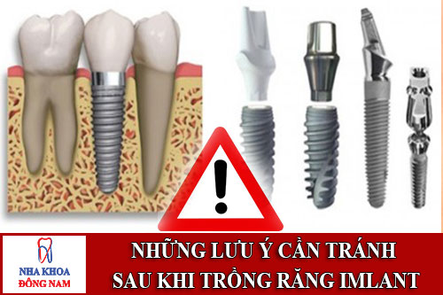 những lưu ý cần tránh sau khi trồng răng imlant