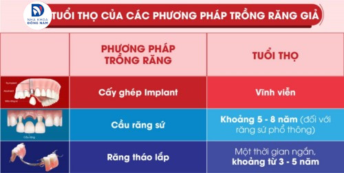 tuổi thọ của các loại răng giả