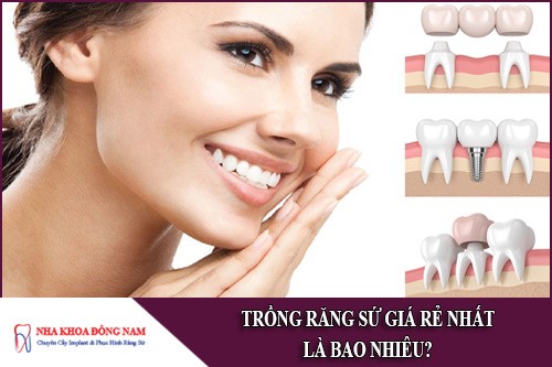 trồng răng sứ giá rẻ nhất là bao nhiêu