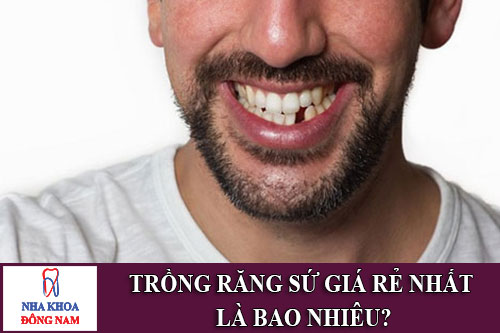 trồng răng sứ giá rẻ nhất là bao nhiêu