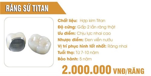 đặc điểm của răng sứ kim loại Titan