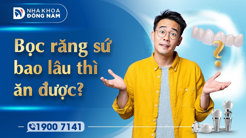 Bọc răng sứ bao lâu thì ăn được
