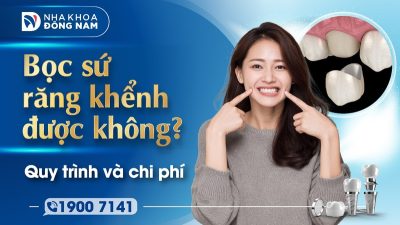Bọc sứ răng khểnh được không