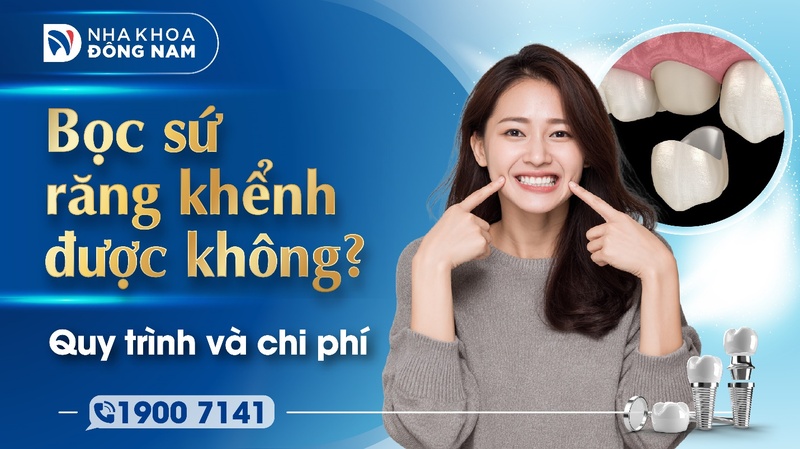 Bọc sứ răng khểnh được không