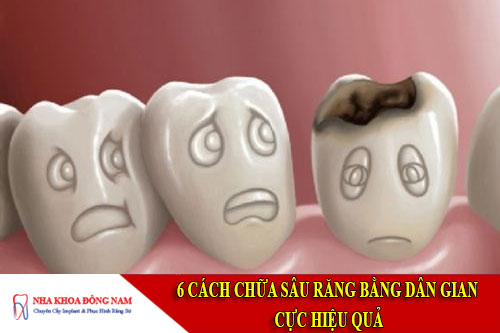cách chữa sâu răng bằng dân gian cực hiệu quả