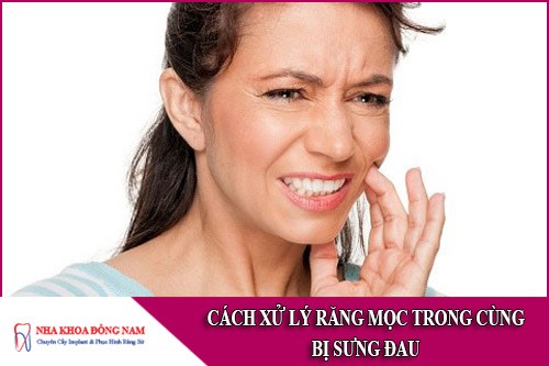 cách xử lý răng mọc trong cùng bị sưng đau