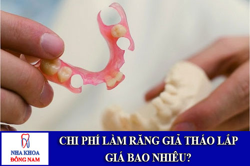chi phí làm răng giả tháo lắp giá bao nhiêu