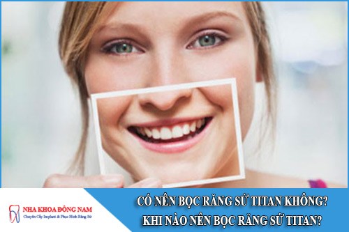 có nên bọc răng sứ titan không? Khi nào nên bọc răng sứ titan