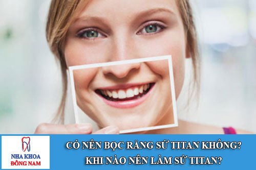 có nên bọc răng sứ titan không