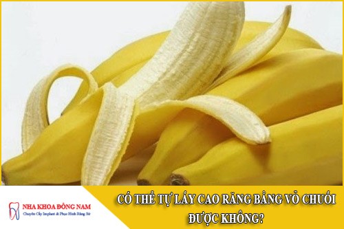 có thể tự lấy cao răng bằng vỏ chuối được không