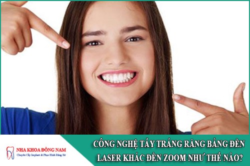 Công Nghệ Tẩy Trắng Răng Bằng Đèn Laser Khác Đèn Zoom Như Thế Nào