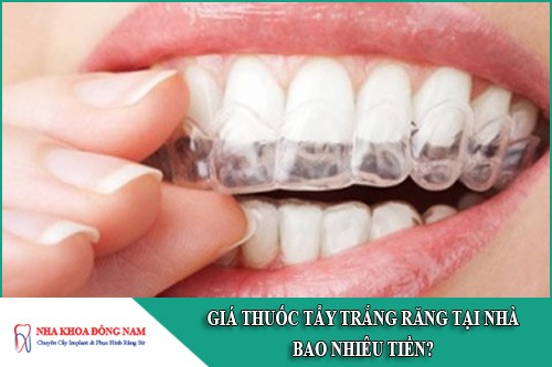 giá thuốc tẩy trắng răng tại nhà bao nhiêu tiền