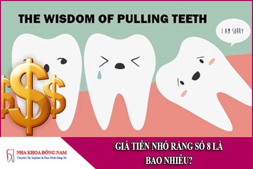 giá tiền nhổ răng số 8 là bao nhiêu