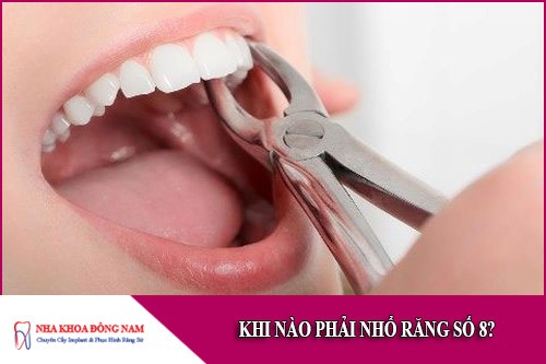 khi nào cần phải nhổ răng số 8