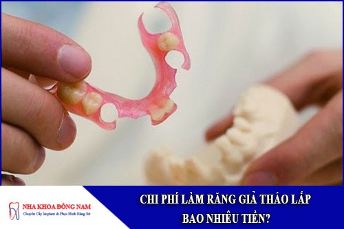 chi phí làm răng giả tháo lắp bao nhiêu tiền