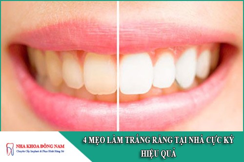 mẹo làm trắng răng tại nhà cực kỳ hiệu quả