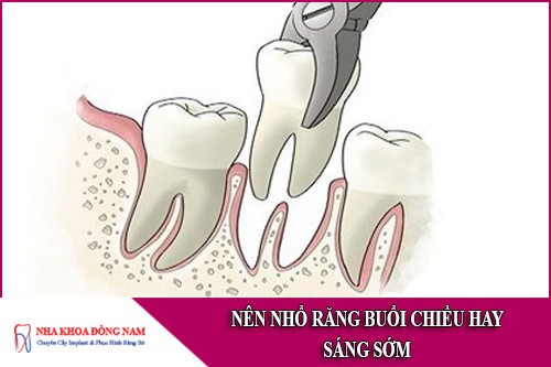 nên nhổ răng buổi chiều hay sáng sớm