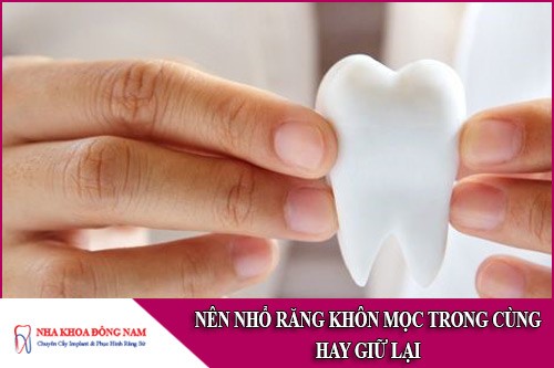 nên nhổ răng khôn mọc trong cùng hay giữ lại