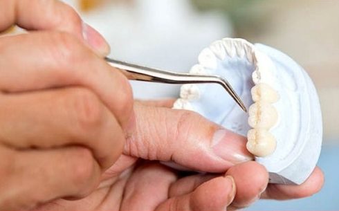 nguyên nhân bị đau răng sau khi trồng răng giả là do đâu 4