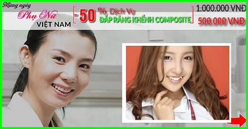 nha khoa đông nam giảm 50% giá đắp răng khểnh composite nhân ngày phụ nữ việt nam 20/10