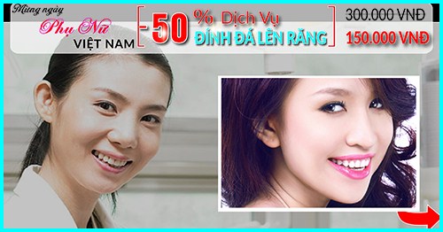 nha khoa đông nam giảm 50% giá đính đá lên răng nhân dịp ngày phụ nữ việt nam 20/10