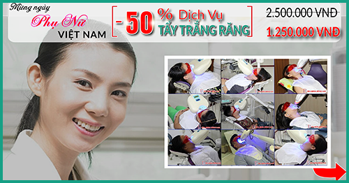 nha khoa đông nam giảm 50% giá tẩy trắng răng nhân ngày phụ nữ việt nam 20/10