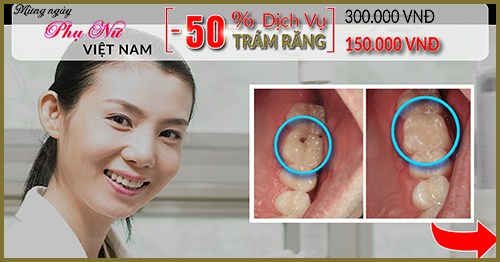 nha khoa đông nam giảm 50% giá trám răng thẩm mỹ nhân ngày phụ nữ việt nam 20/10